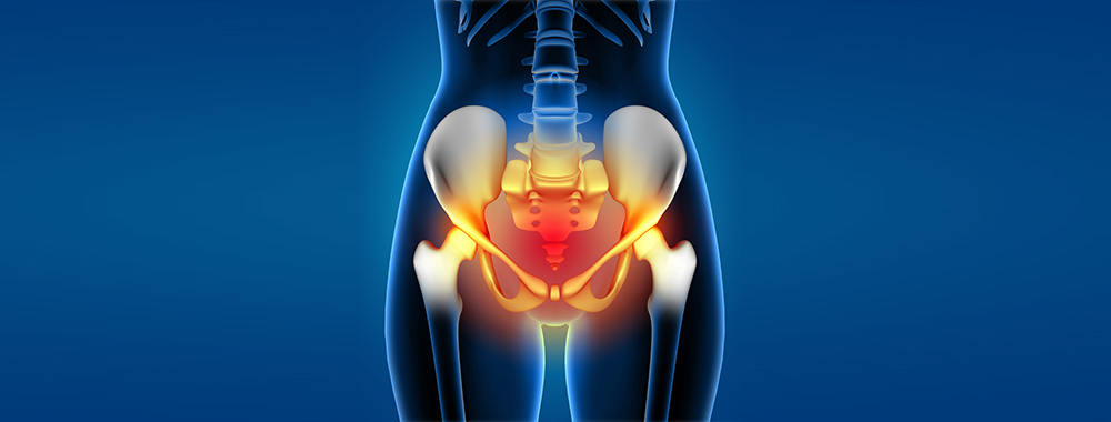 dolore-Pelvico-Cronico